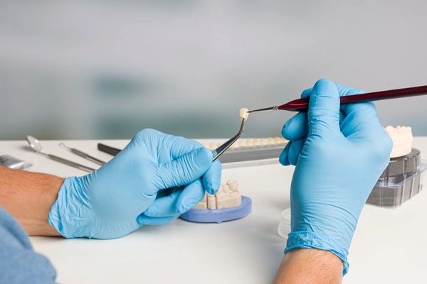 Alternatives To Dental Crowns: Exploring Other Dental Restoration Options